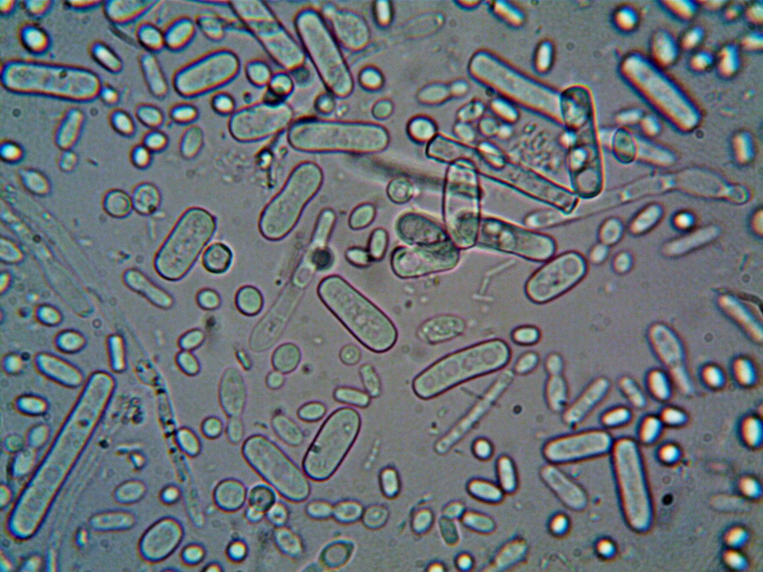 Close-up image of rod-shaped bacteria under a microscope, showcasing microscopic detail.