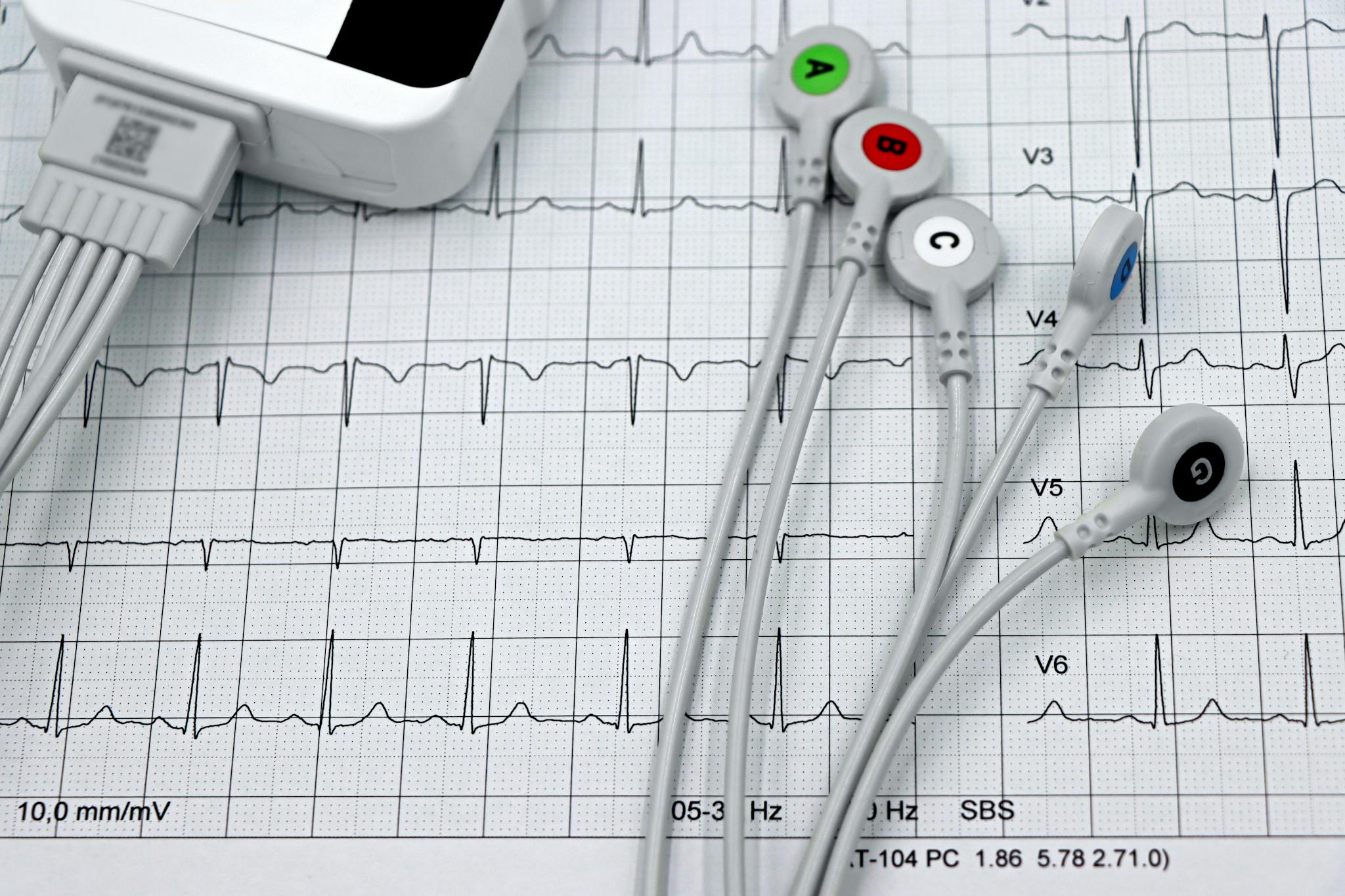 Close-up of ECG monitor leads on a printed cardiogram, showcasing heart health diagnostics.