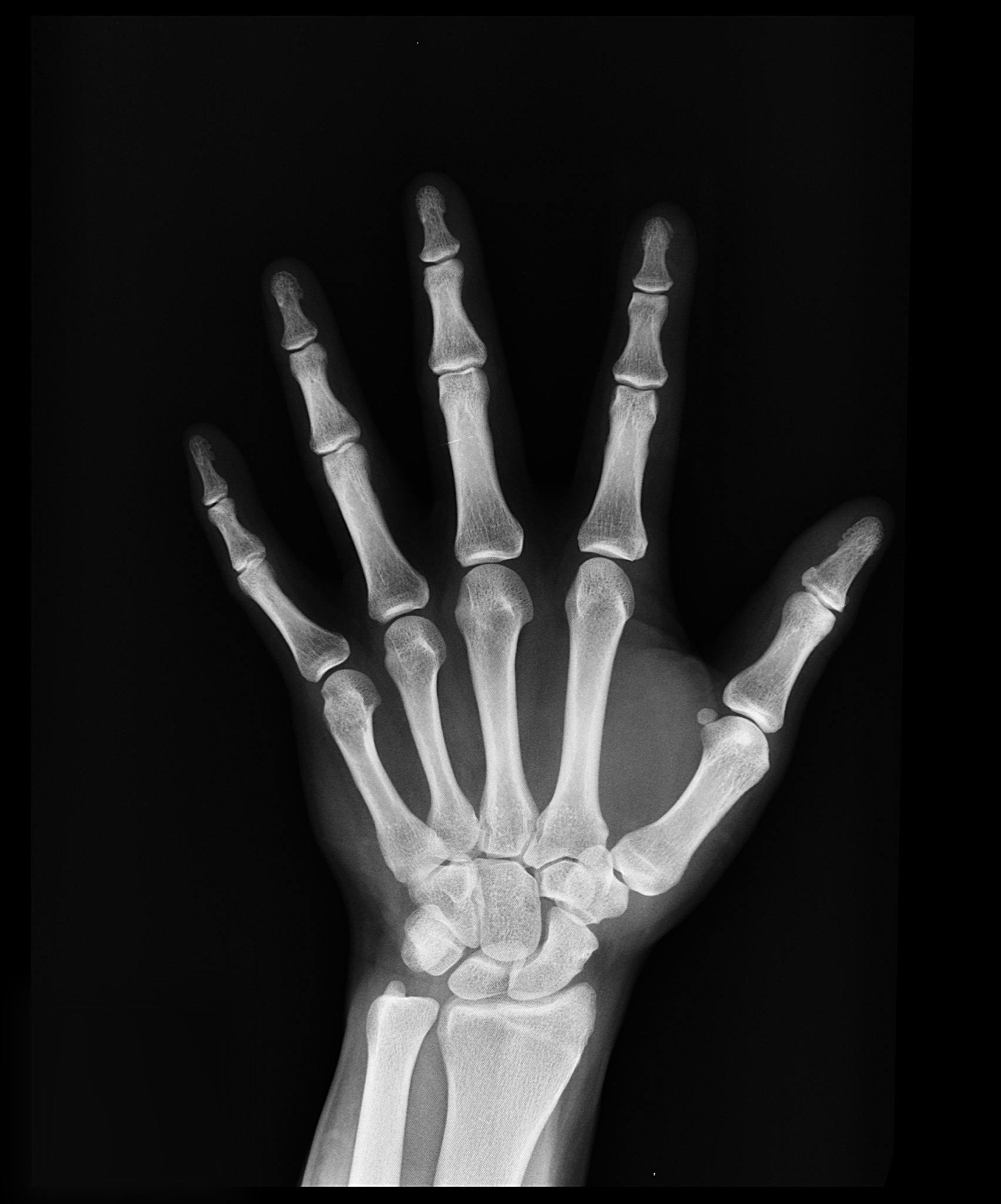 High-resolution X-ray capturing the bones of a human hand, displaying skeletal anatomy.